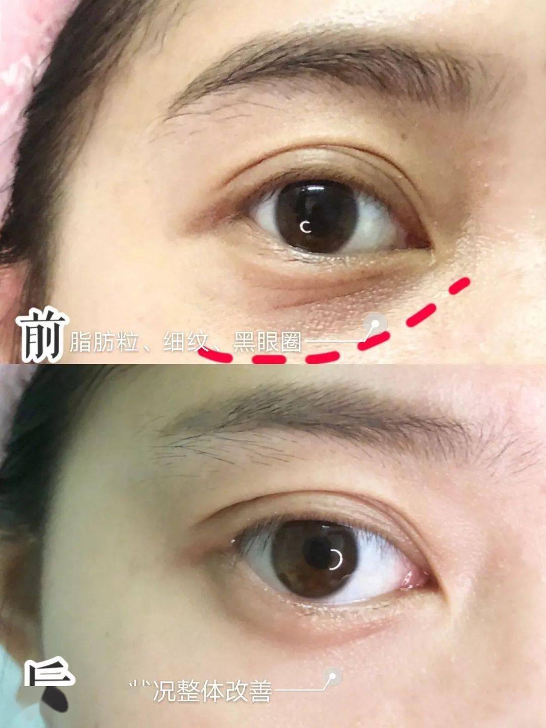 如何让眼睛变成黄色 54f9eb72a3b94870b79d8a0ffa3edf3d.jpeg