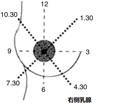 读懂体检单丨乳腺甲状腺结节离癌症有多远一文教你看懂结节的好与坏