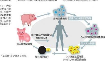 人体器官移植有望靠猪异种器官移植能否救人一命