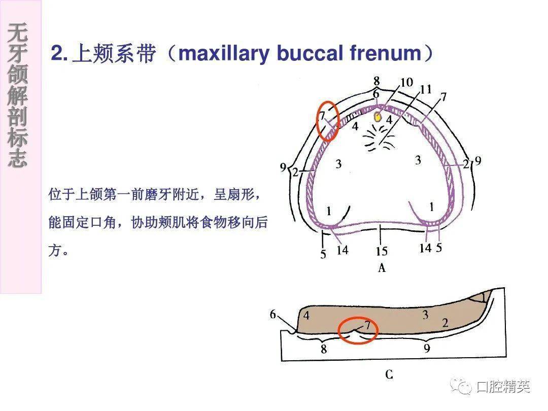 无牙颌解剖标志