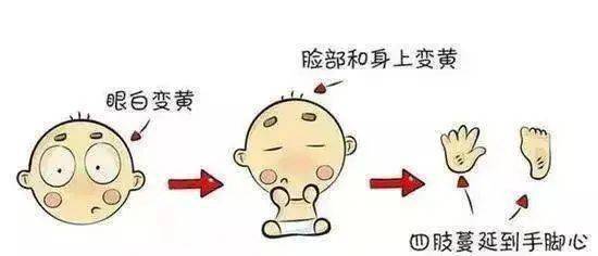 【科学育儿】新生宝宝出现黄疸怎么办?如何避免胆红素