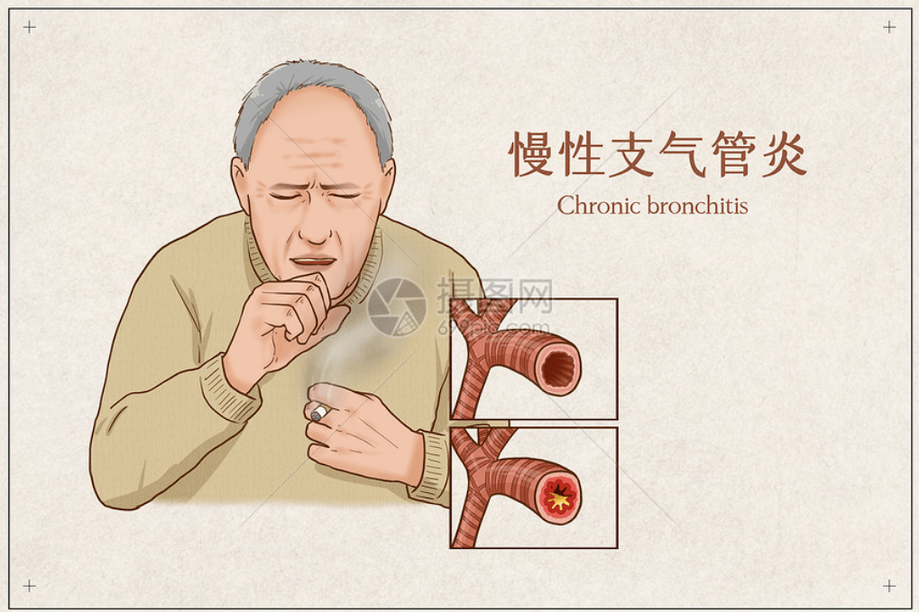 支气管炎医院排名_支气管炎医院证明