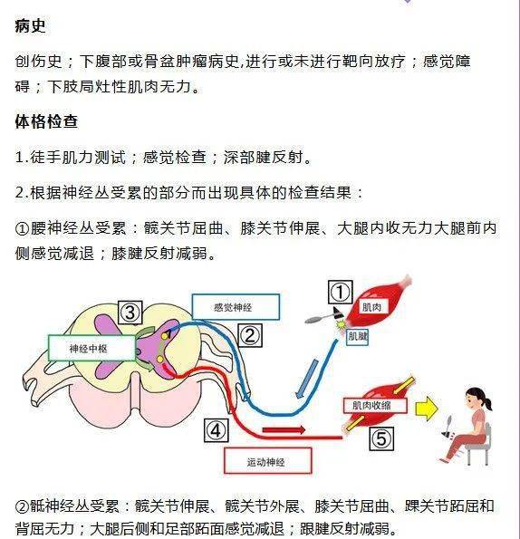 腰骶丛神经病变