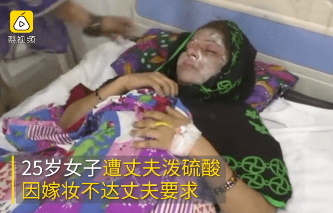 3名女大学生被泼硫酸头发被融脸上冒烟别再与恶魔共情