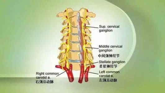 星状神经节阻滞疗法_手机搜狐网