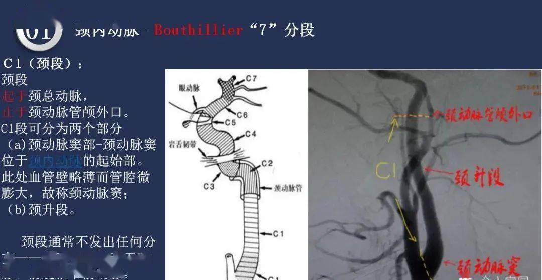 头颈动脉系统相关解剖