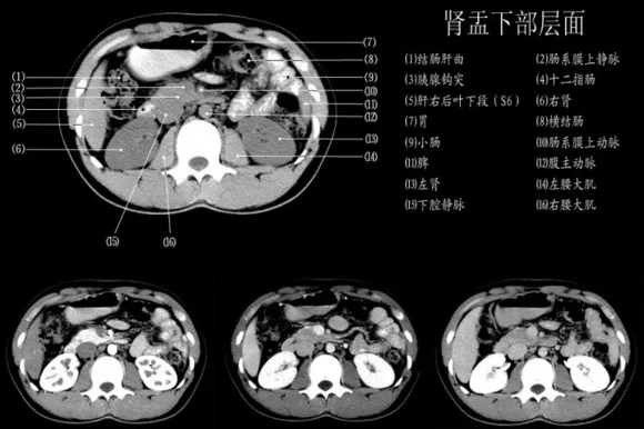 绝对不容错过!1小时带你读懂腹部ct