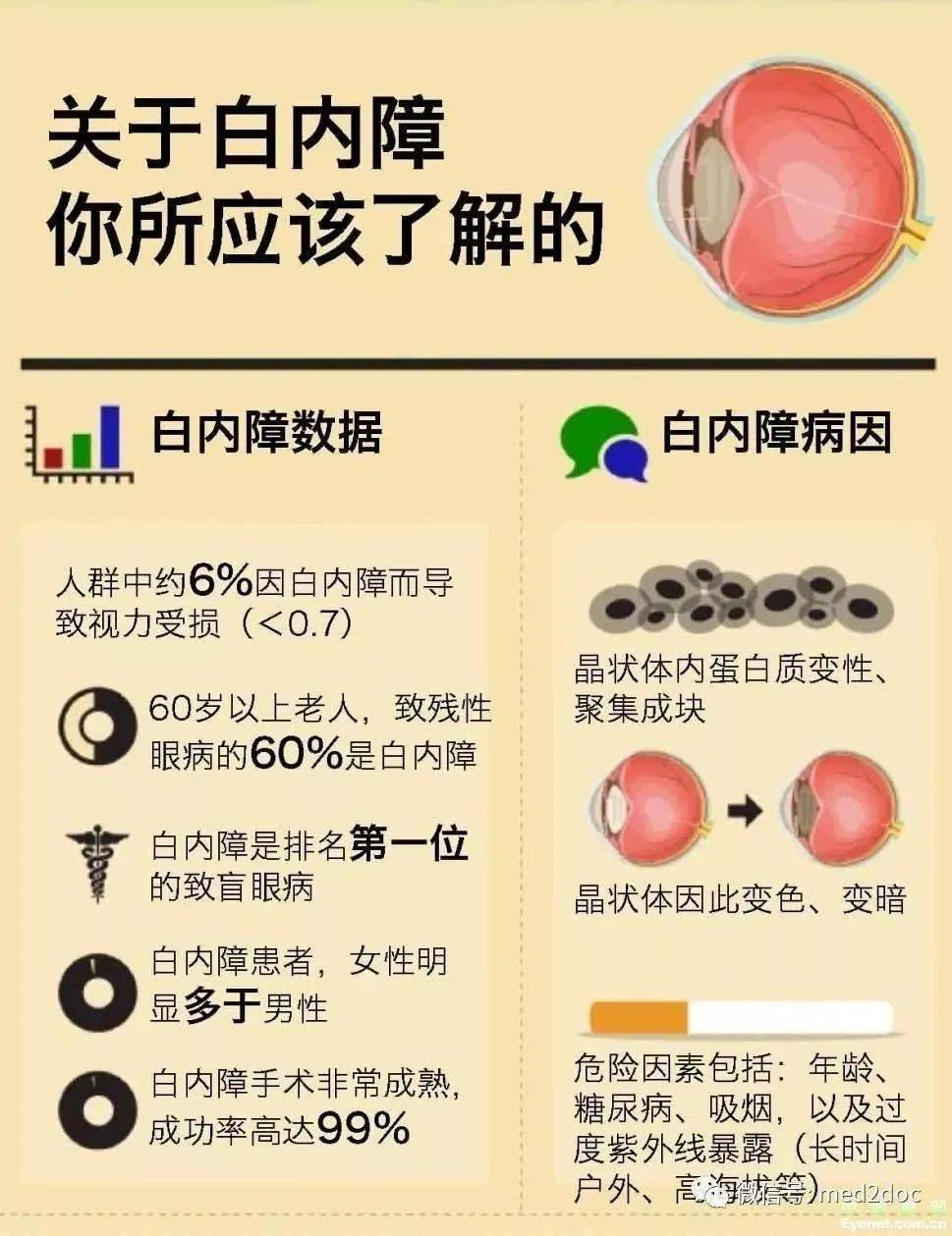 科普了解白内障上