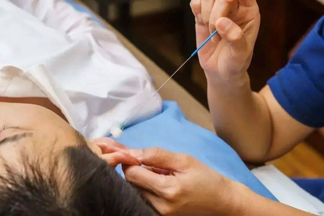 什么是采耳 来自搜狐网