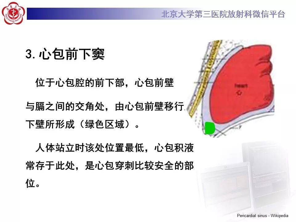 心包窦及心包隐窝解剖