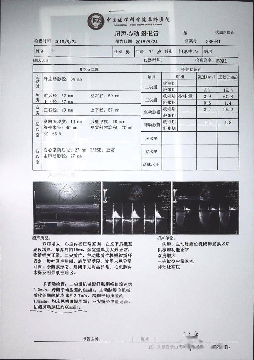 肺动脉高压案