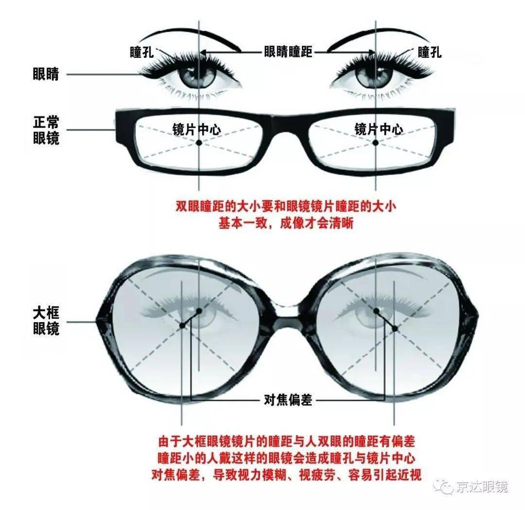 散光,高度近视为什么不可以选择大镜框