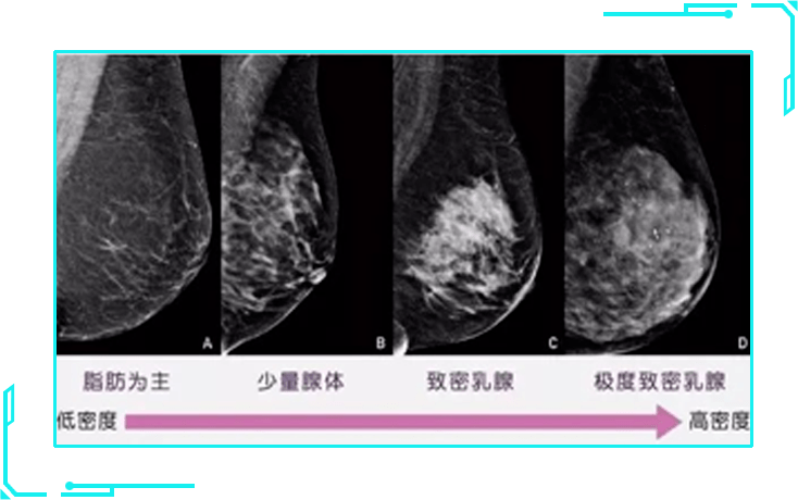 乳房太紧实竟更易得乳腺癌这类化妆品用不对就成帮凶