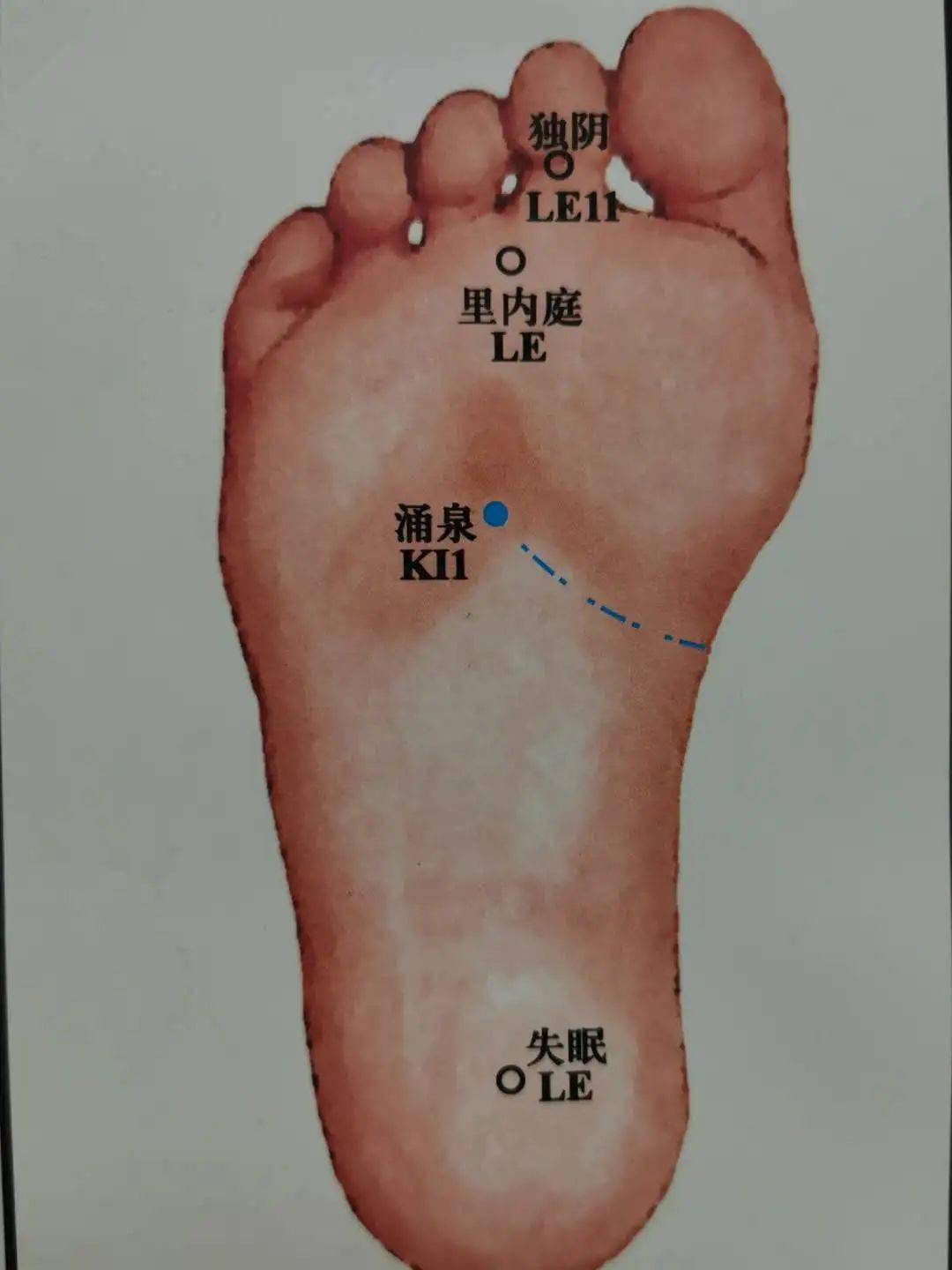 "树老根先枯,人老脚先衰",养好脚下金矿——涌泉穴