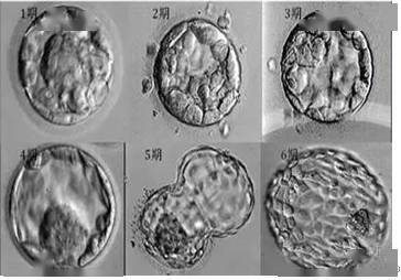 (图:囊胚发育6个时期)