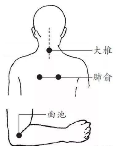 恶寒无汗,高烧不退,灸一次即可退烧!