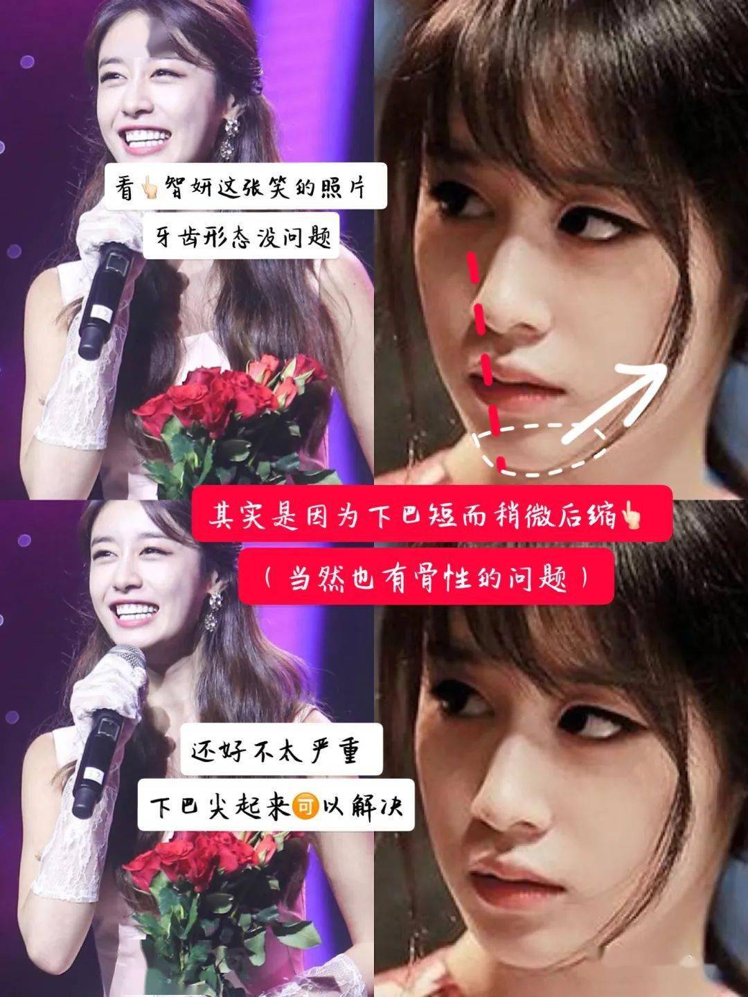 即使凸嘴,看其他五官的配合再加上身材和气质有点凸嘴也完全不影响