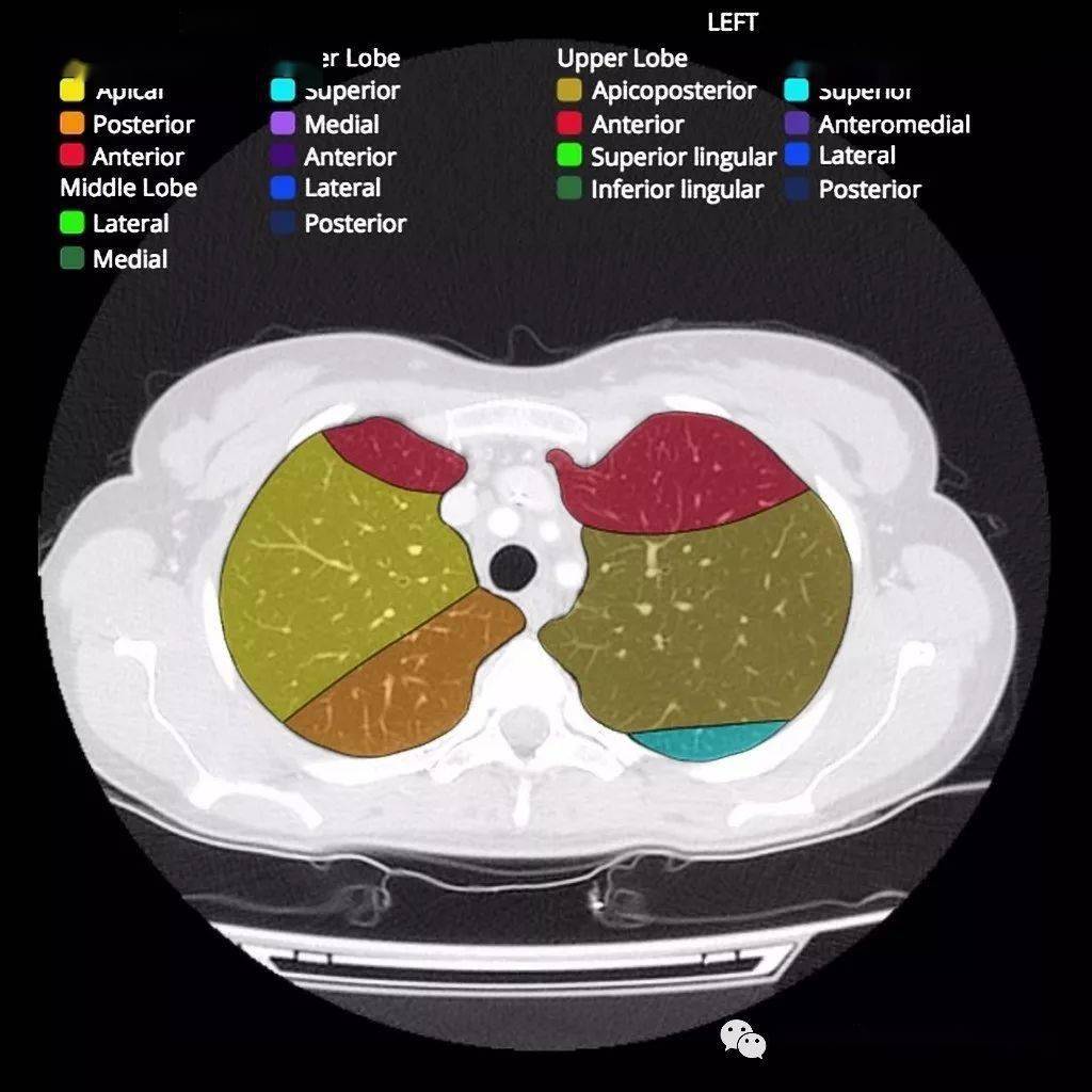 ct肺段解剖(图)