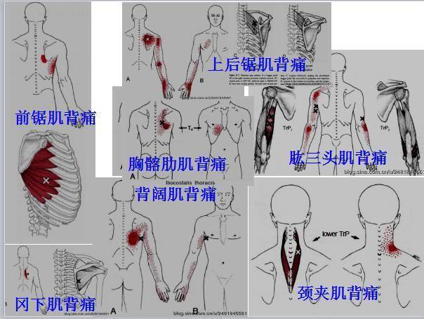 肌(scaleni)  胸锁乳突肌(sternocleidomastoid)  胸骨肌(sternalis)