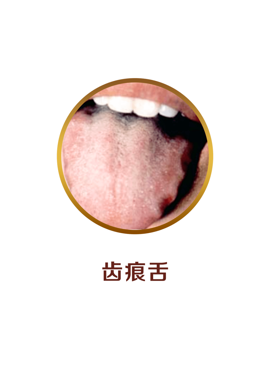 注意:这4种舌苔,是宝宝健康在预警!