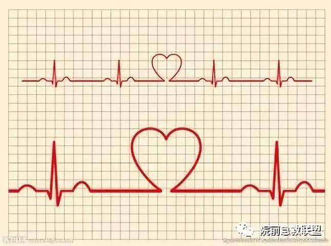 【心电图】12导与18导心电图机的区别