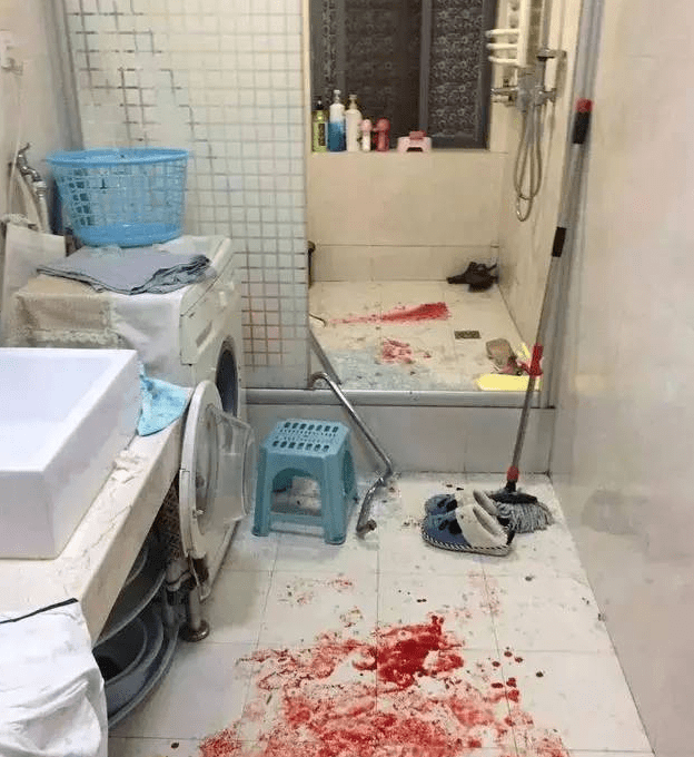 11岁男孩小腿被划伤,血流一地