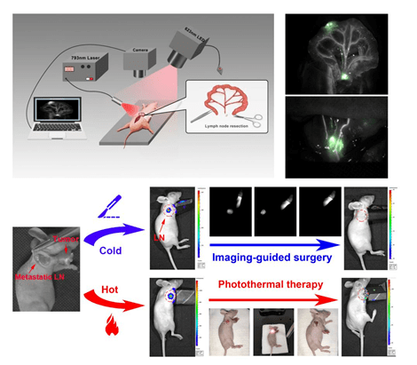 as:近红外二区荧光多通道成像精准指导肿瘤淋巴结清扫