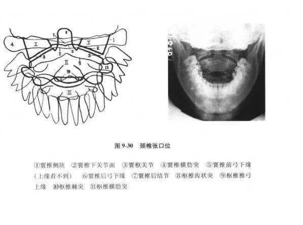 各椎体及椎间关节有无变形及狭窄;双侧钩突关节有无增生及其他异常;椎