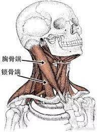 锁骨部起于自锁骨内1/3段上缘,两头间的三角形间隙恰在胸锁关节上方