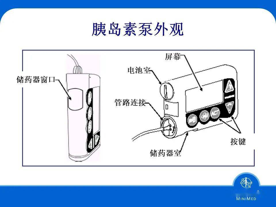 ppt胰岛素泵的使用下