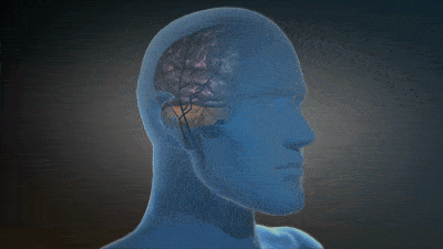 数字疗法γ频率神经调节治疗阿尔茨海默病