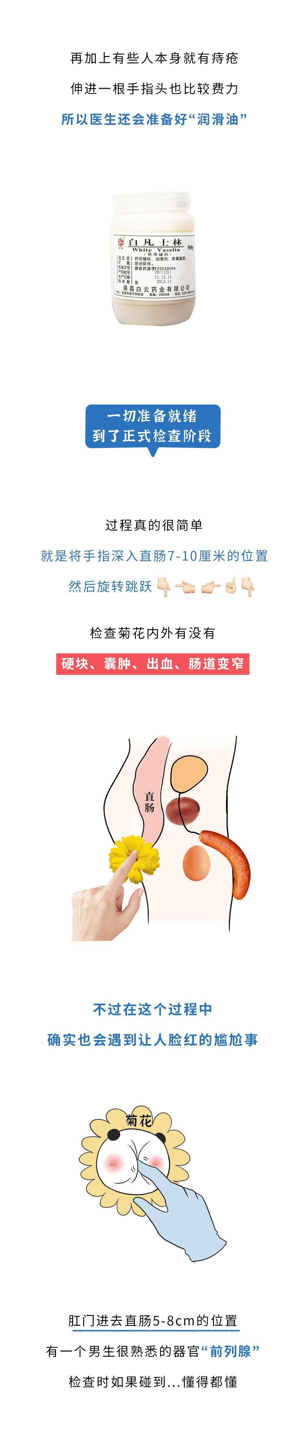 主动做肛门指检是一个男人成熟的标志