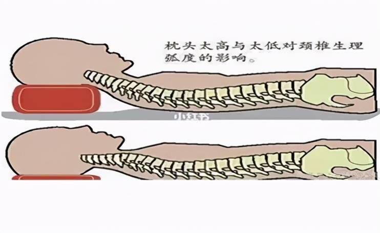 孟津二院外三科大讲堂丨颈椎病的正确睡姿