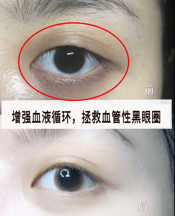 南京市医院“黑眼圈门诊”火热背后是患者精细化的诉求