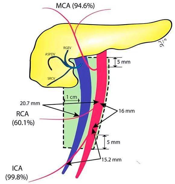 3,右结肠动脉(right colic artery,rca)