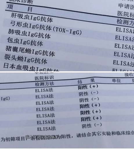 四项抗体指标 均显示为阳性