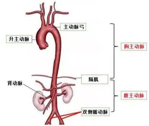 王庆亮医生"中招"的,正是  "主动脉夹层,主动脉根部动脉瘤".