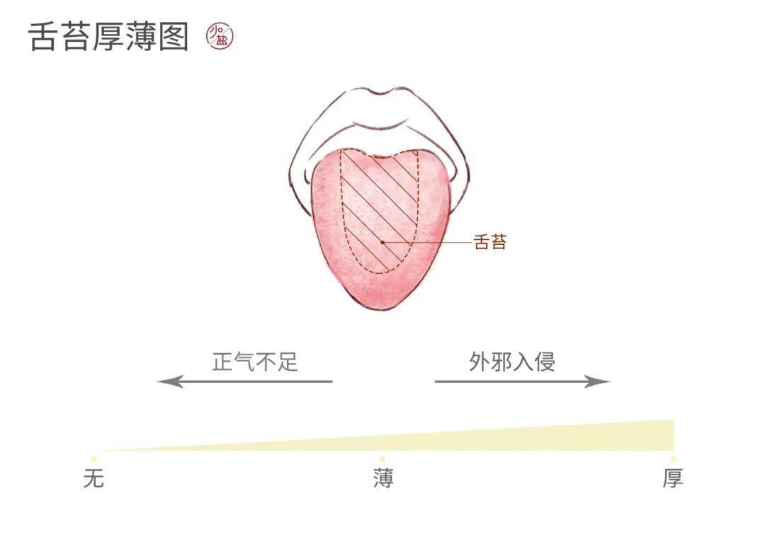 舌苔厚薄反应了体内正气的情况,舌苔变厚了,说明体内有外邪.