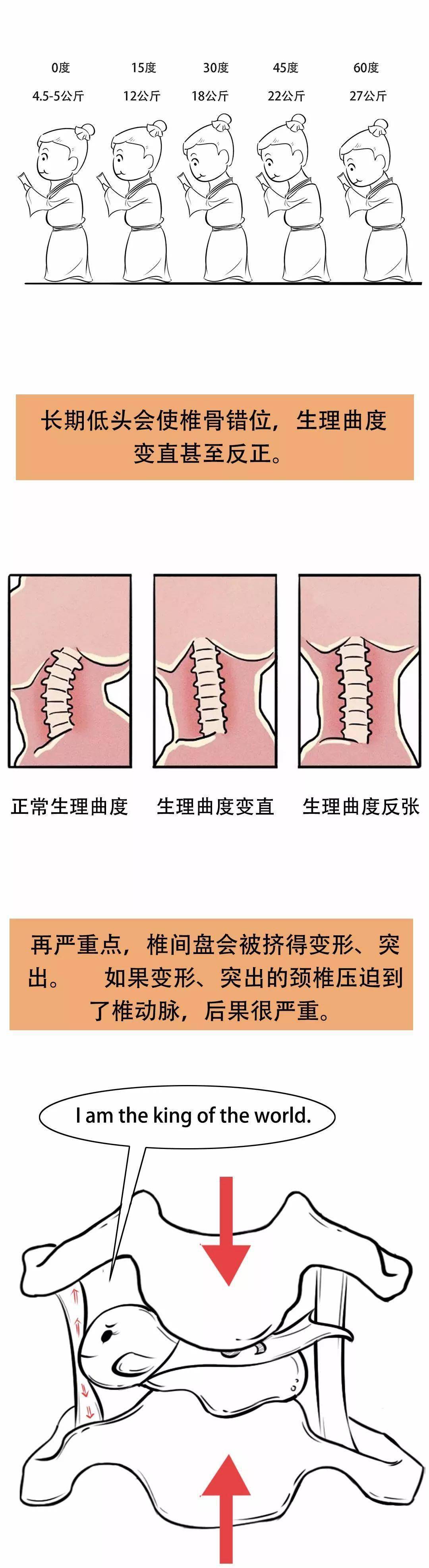 你的颈椎是怎么坏掉的漫画版