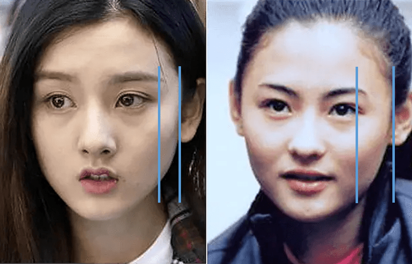 如果单看皮相,反而宋祖儿的眼睛量感更大,鼻子高度更好,额头也更饱满