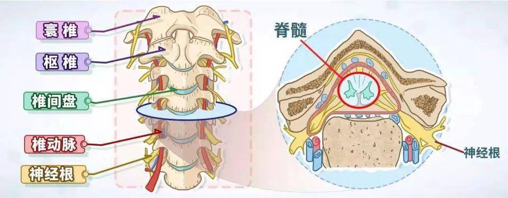 颈椎附近有重要的 神经,血管等结构走行,也有 韧带肌肉等维持颈椎的
