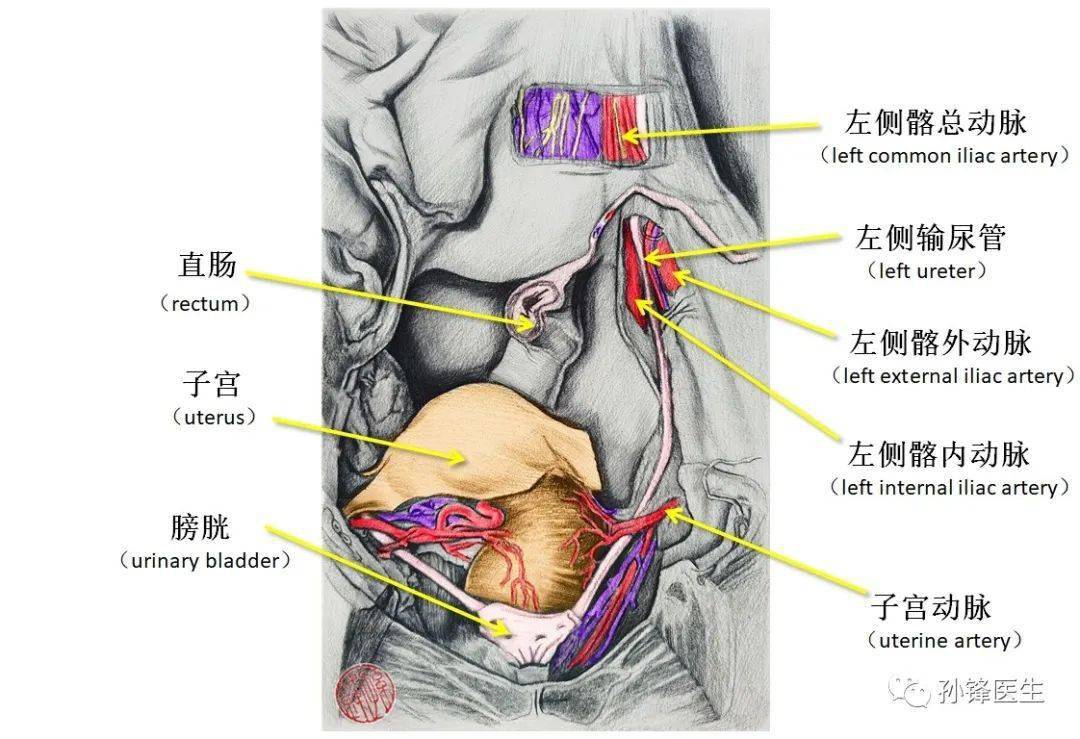 医学笔记|"输尿管盆部"保护的应用解剖(图文)