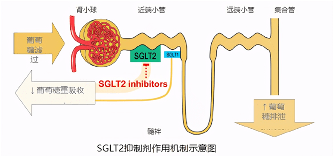 跨界明星降糖药sglt2抑制剂