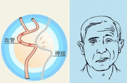 扩散7月13日省立医院权威神经外科专家张良文教授到邹