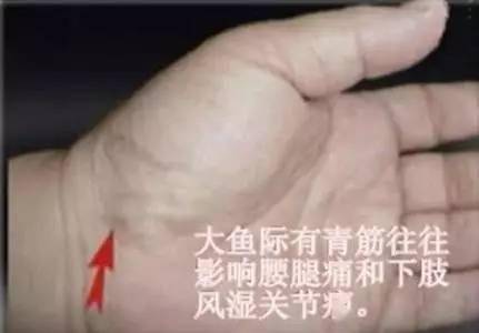 (2)腕部横纹线有青筋,往往提示妇科疾病,如月经不调,带下等.