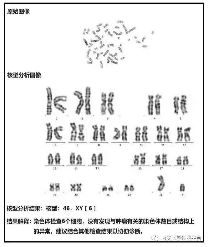 染色体核型分析