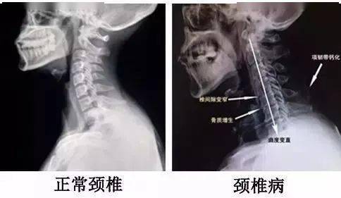颈椎人的自救指南,老戏骨实力派演员张晨光推荐,3d按摩,肩颈,腰背