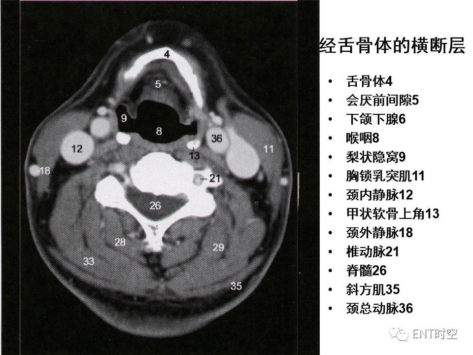 三,喉的解剖位置喉软骨喉的连结喉肌喉腔(一)喉软骨 laryngeal