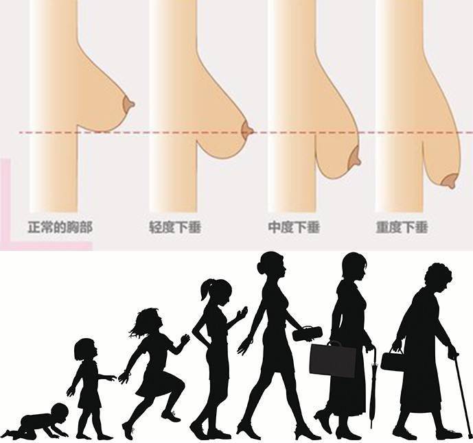 从40岁起,女人乳房开始下垂,乳晕(乳头周围区域)急剧收缩.