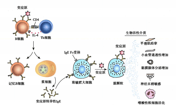 各型超敏反应别再分不清了